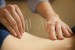 8 Facts about Acupuncture