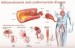 8 Facts about Atherosclerosis