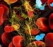10 Facts about Blood Cancer
