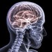 10 Facts about Brain Injury