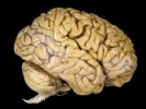10 Facts about Brain