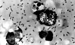 10 Facts about Bubonic Plague