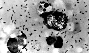 Bubonic Plague Bacteria