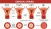 10 Facts about Cervical Cancer
