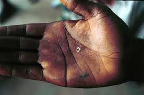 Facts about Conflict Diamonds